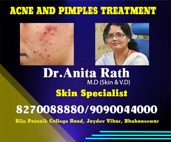 best acne treatment clinic in bhubaneswar - Dr Anita Rath